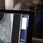 Ministério da Saúde passa a recomendar mamografia a partir dos 40 anos