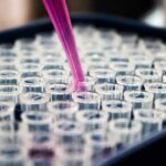 Pesquisas brasileiras avançam no diagnóstico de Alzheimer