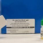 Novo teste faz diagnóstico de hantavirose em 20 minutos